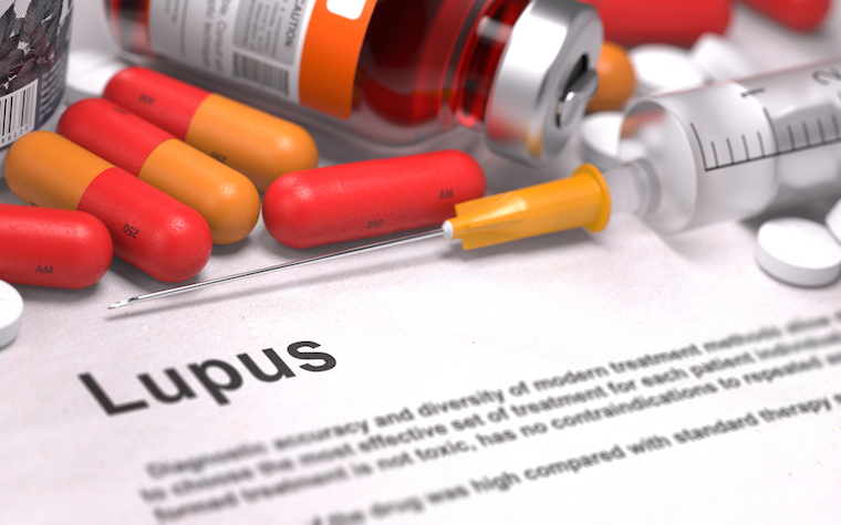 Lonza will provide Aurinia with cGMP-grade voclosporin drug substance for use in Aurinia’s Phase III lupus nephritis clinical program.