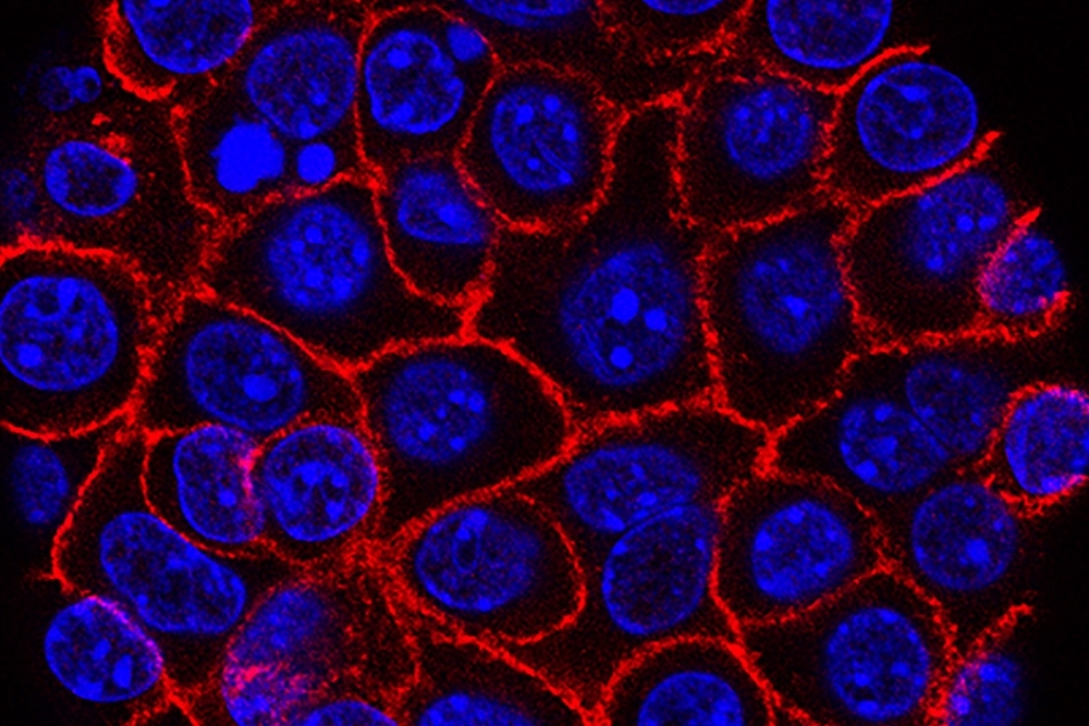 How Pancreatic Cancer Defies Treatment Current Science Daily