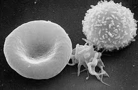 First-ever INTERCEPT pathogen reduced platelet units in US