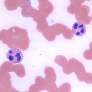 Anticancer drug helps immune system battle infection
