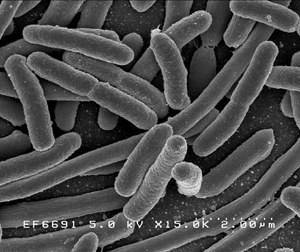 E. Coli bacteria under an electromagnetic microscope.