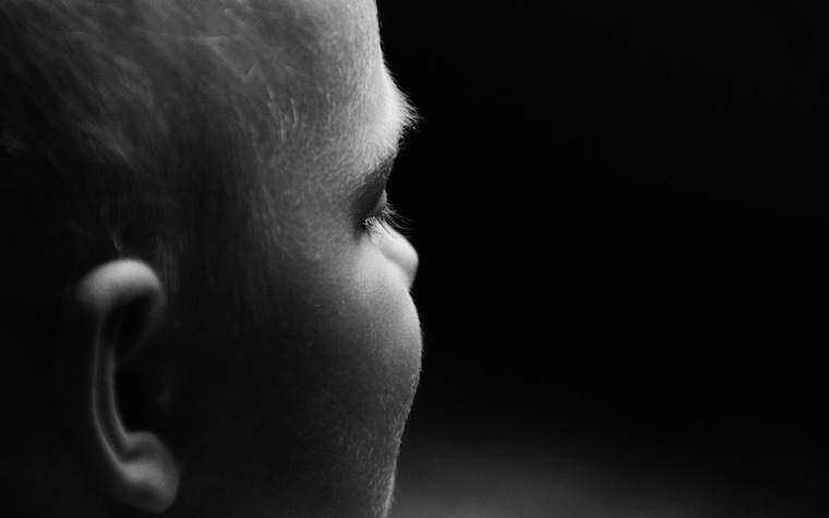 The work targets cochlear implants among preschoolers.