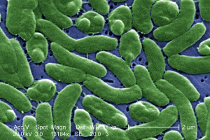 WHO releases details on Iraq's cholera outbreak.