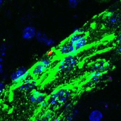 A new study finds that Yersinia pestis, the bacteria that cause bubonic plague, like the one pictured (red), doesn't need a host cell to grow.