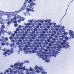 Colorized chikungunya virus particles.