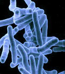 Human immune system’s unique method of fighting TB