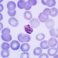 MDA credited with stopping malaria spread in Greece