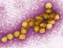 Viral hemorrhagic fever cases reported in Darfur.
