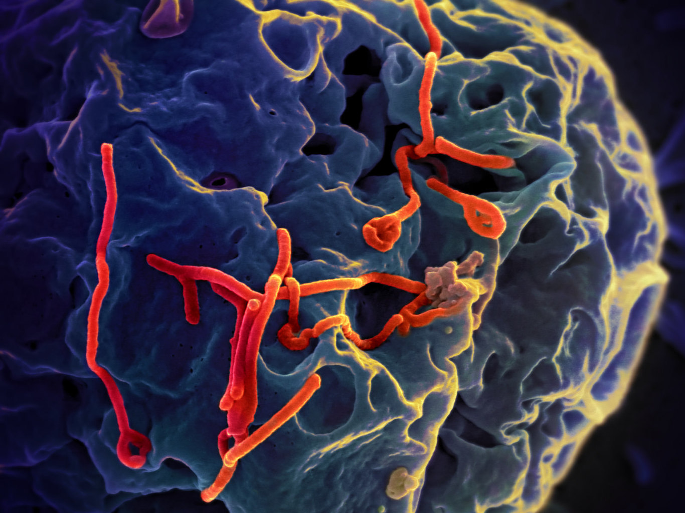 Vaccine trial expands to Sierra Leone due to new Ebola case.