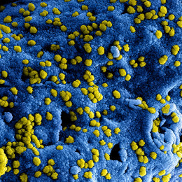 Positive feedback for MERS treatment from Hemispherx Biopharma Europe