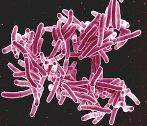 Immune correlates, or biomarkers, are used to measure if a vaccine has successfully induced immunity.