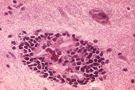 Mississippi confirms first land animal rabies case in 50 years.