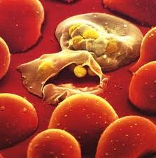 A new compound, (+)-SJ733, destroys malaria-infected cells without harming healthy ones using the body's own defenses.