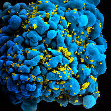 Congress pushes CDC and White House to extend funding for HIV prevention