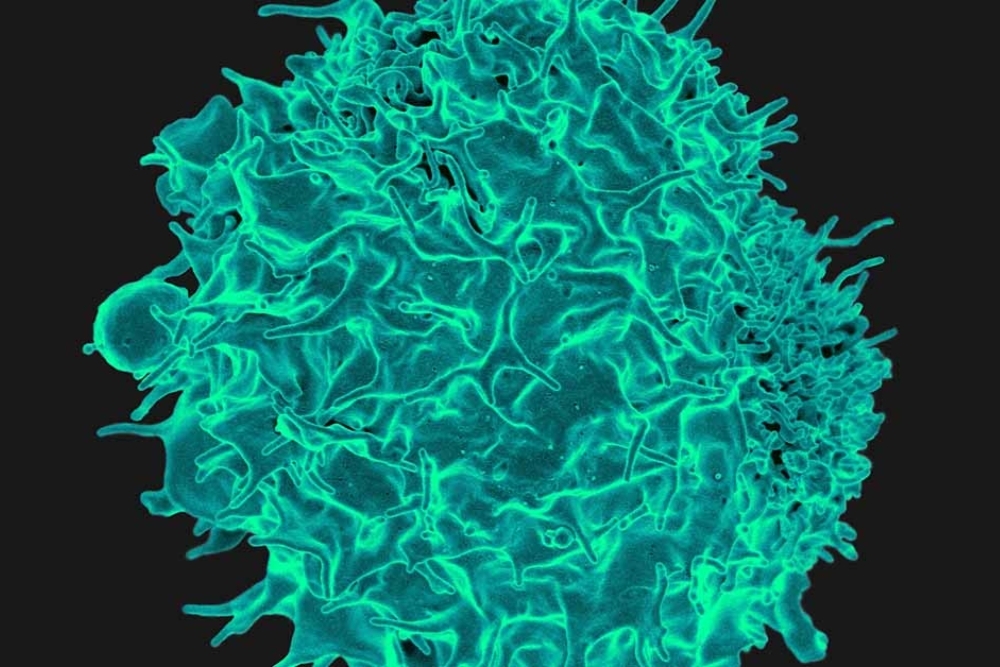 TissueSpecific Immunity May Be the Future, if We Can First Learn its