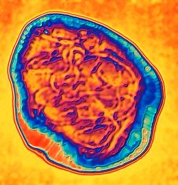 Experts encourage vaccination to protect against measles