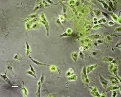 UTMB study suggests hydrogen sulfide fights RSV infection