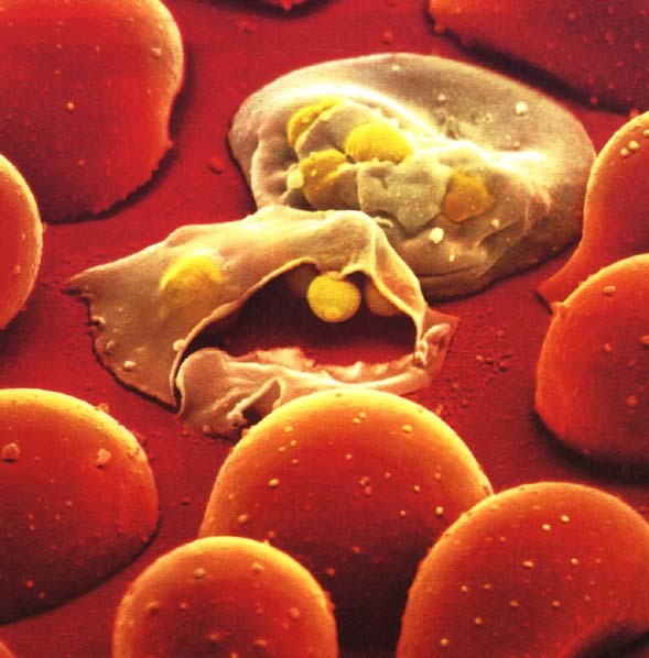 P. vivex malaria