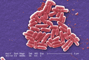 E. coli under 6,83x magnification.