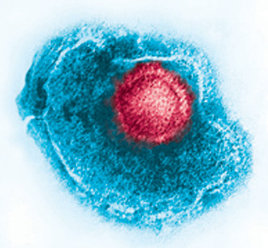 GSK shingles vaccine candidate proves 97.2% efficient