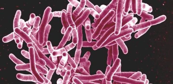 Genetic clues to TB immune response