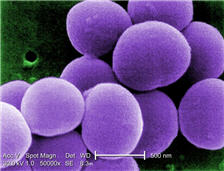 Researchers used Staphylococcus aureus in order to test improved methods of delivering drugs in cases of lung infections.