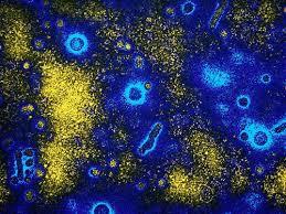 TetraLogic releases update about Hepatitis B clinical program