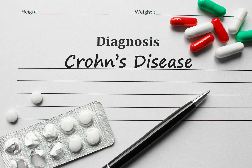 Risankizumab is being assessed for the treatment of immunological disorders such as Crohn’s disease.