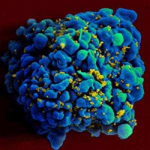 Immune systems manage bursts of HIV activity