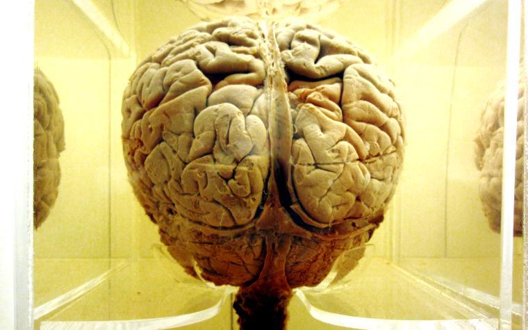 The research team continues to investigate hypotheses regarding the metabolic pathways and how they regulate brain functions.