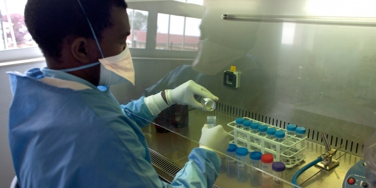 Many Advanced Rapid Diagnostic Tests don’t detect multi-resistant TB strain from Swaziland