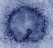 Human cases of avian influenza A in China