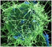 Early hospitalizations crucial for people to survive Ebola.