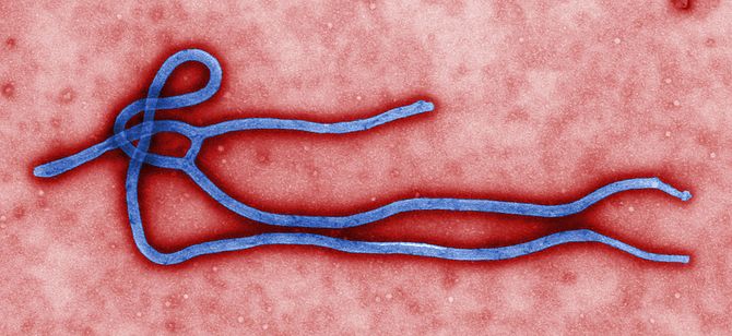 The Ebola virus