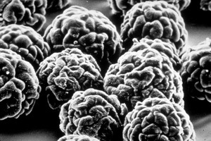 5th IHR Emergency Committee statement about wild poliovirus spreading internationally