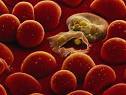 New vaccine for placental malaria