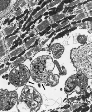 Mice receive long-term protection from Chagas disease vaccine