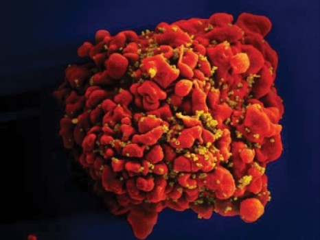 ople who recently have been infected with HIV may not be as highly infectious as previously believed, a finding that could improve global efforts to prevent HIV transmission and save lives. In particular, the finding bolsters the strategy of treating pati