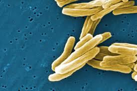Freshwater sources may help fight drug-resistant TB and other infections.