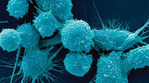 Madison Vaccines expands investigational prostate cancer vaccines