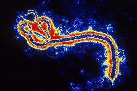 Health officials fear that vaccination efforts against whooping cough, measles and other diseases in West Africa have been weakened after most resources were shifted in response to the Ebola outbreak.