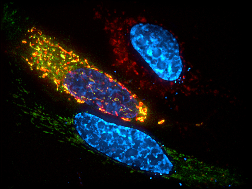 Researchers have revealed the protein structure of VSV.
