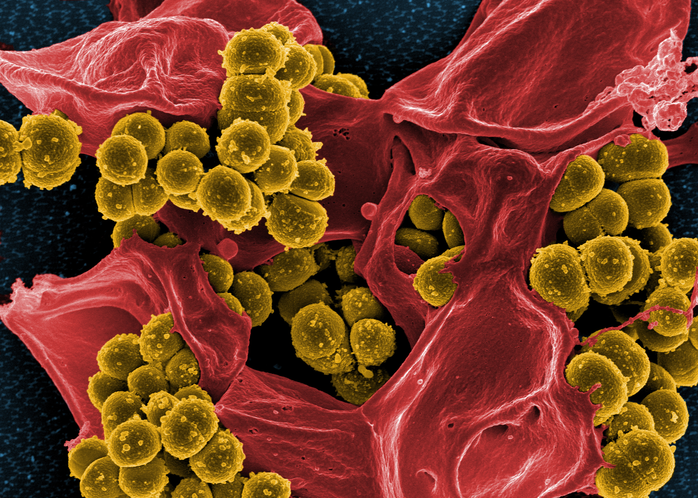 FDA OKs new test to detect MRSA, SA infections.