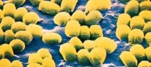 Anthrax spores
