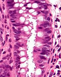 Innovative tools to fight Cryptosporidium