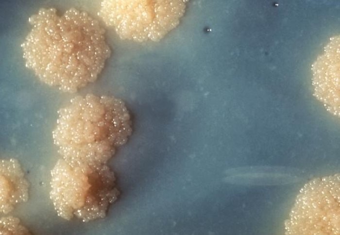 DNA sequencing traces drug-resistant TB