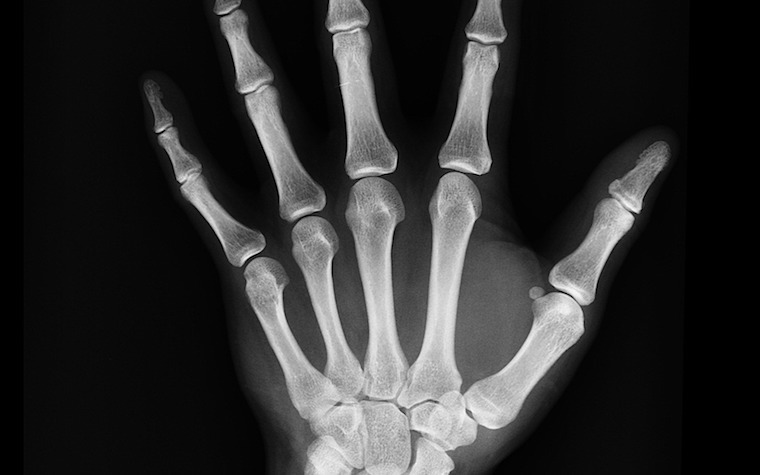 Brown University X-ray Reconstruction of Moving Morphology technology advances research