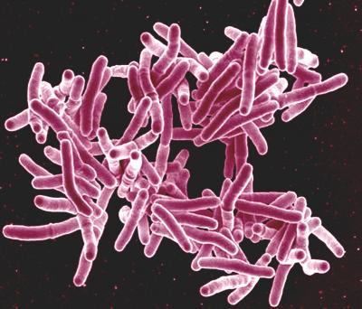 New TB action plan for WHO European region