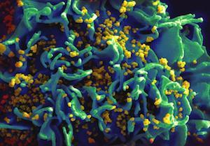 The SIV virus disseminates through the body rapidly, finding genetic material from the virus in tissue outside of the reproductive tract within one day of exposure.