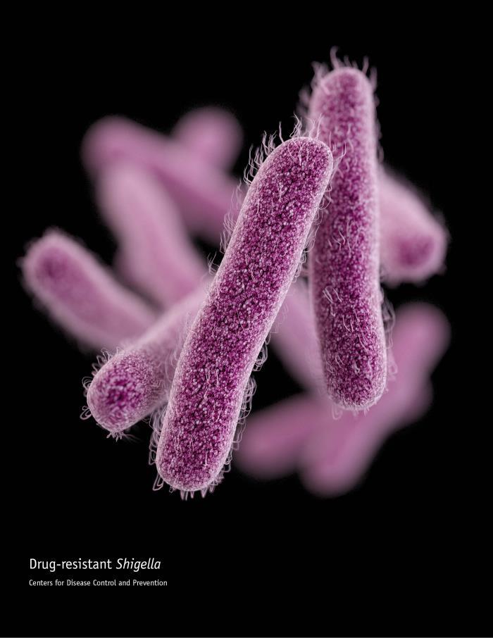 Multidrug-resistant shigellosis spreads through US